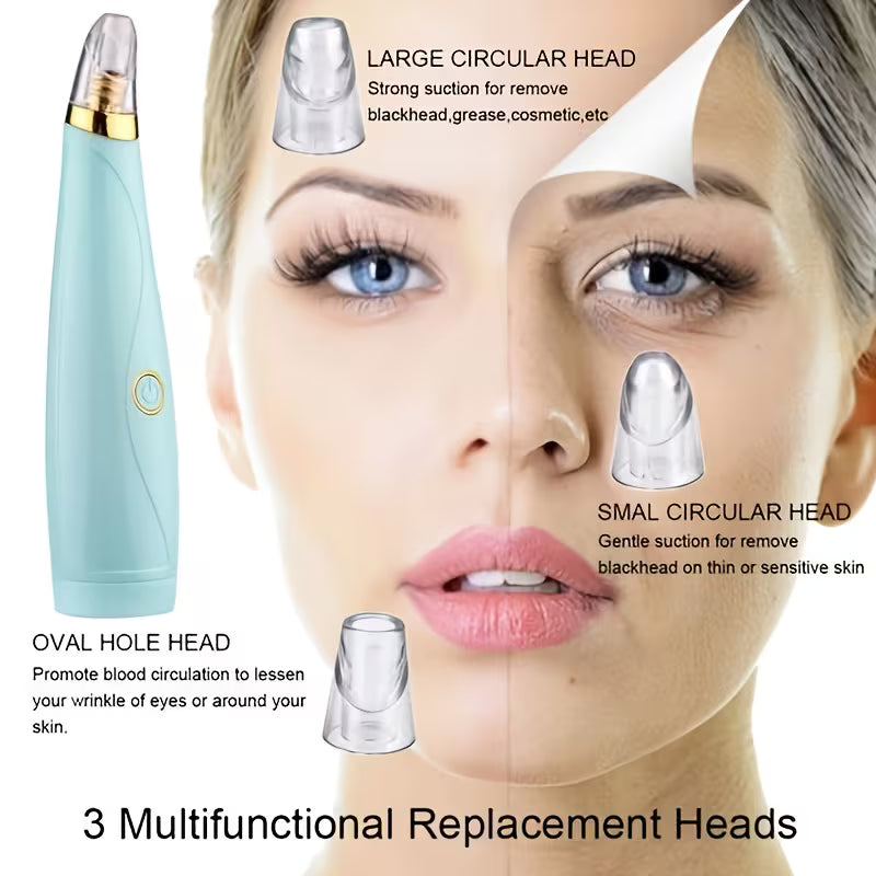 Blackhead Remover Pore Vacuum – Battery-Powered Deep Pore Cleaner