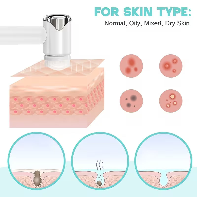 6-in-1 Electric Facial Cleansing Brush Set – Deep Clean
