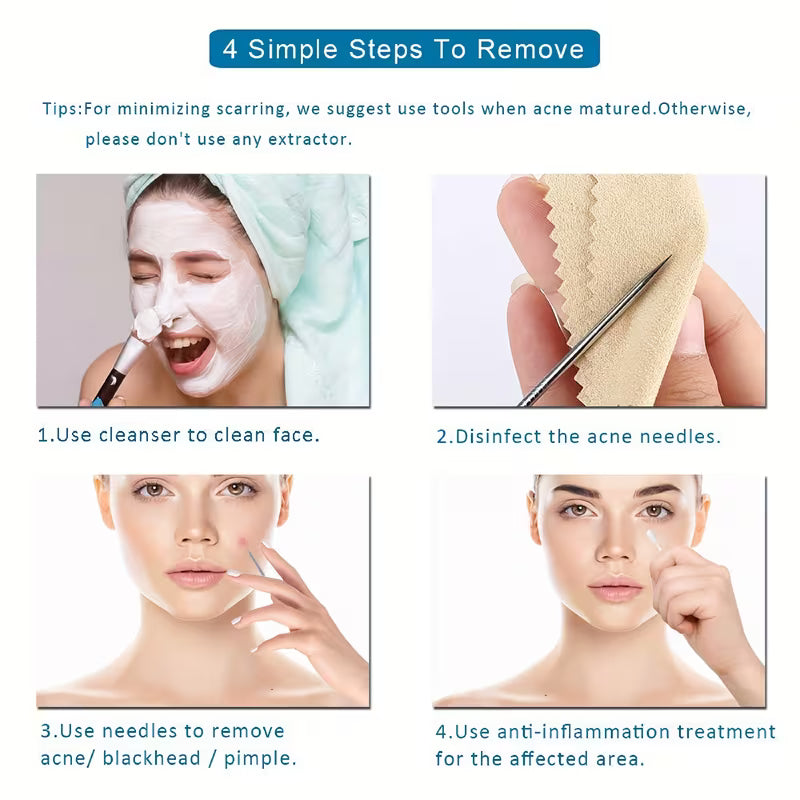 4pcs Blackhead Remover Tool Kit – Comedone Extractor Set