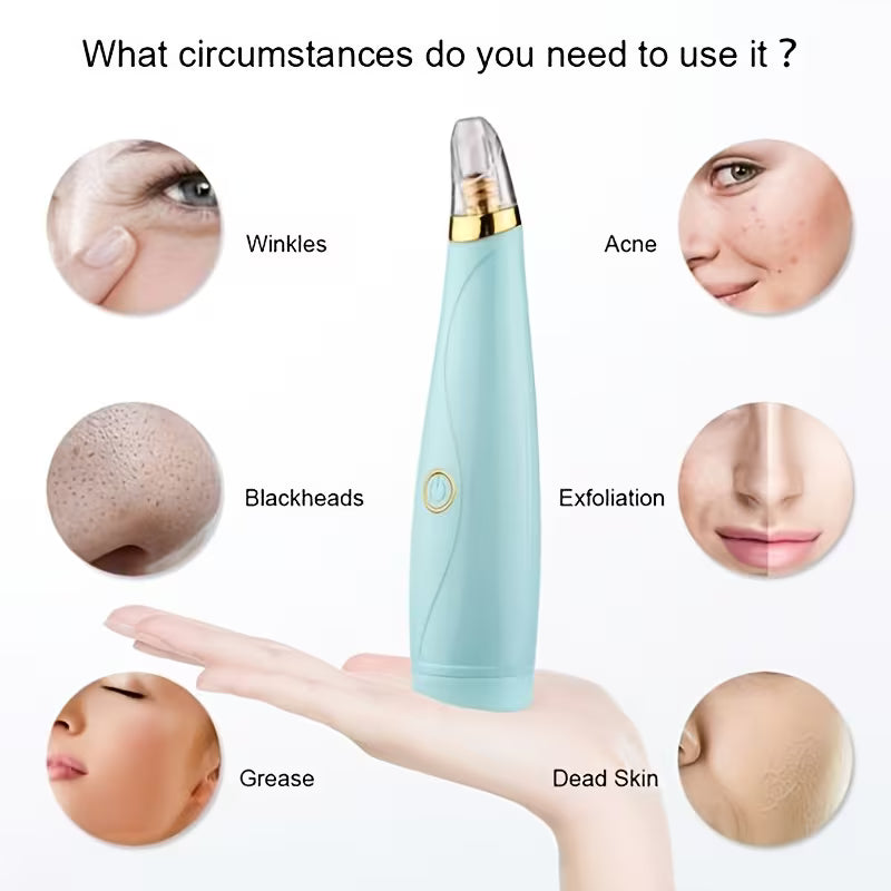 Blackhead Remover Pore Vacuum – Battery-Powered Deep Pore Cleaner
