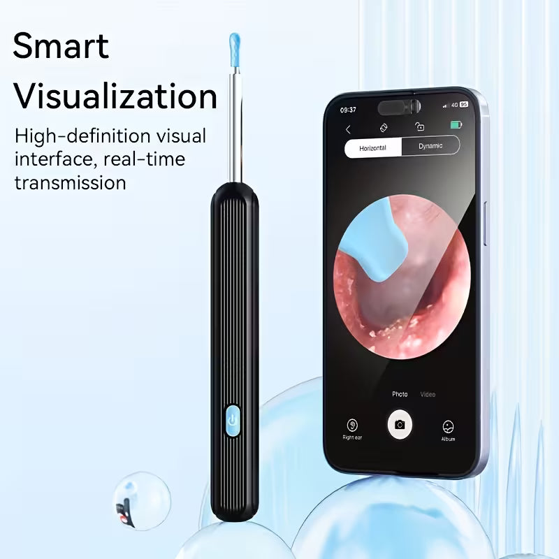 Wireless Earwax Removal Tool with Camera & Light – Smart Visual Ear Cleaner Kit