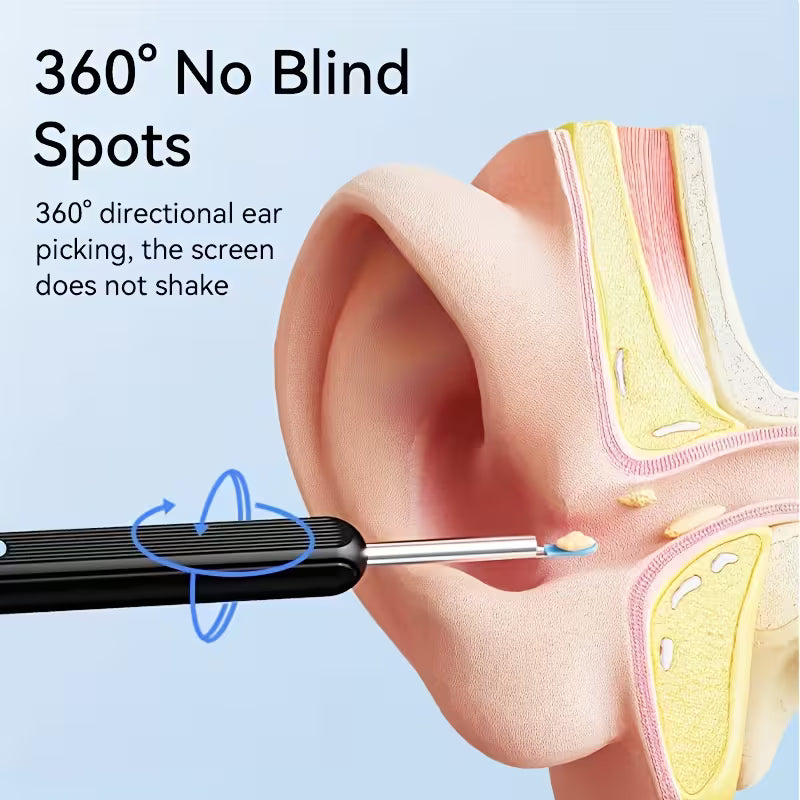 Wireless Earwax Removal Tool with Camera & Light – Smart Visual Ear Cleaner Kit