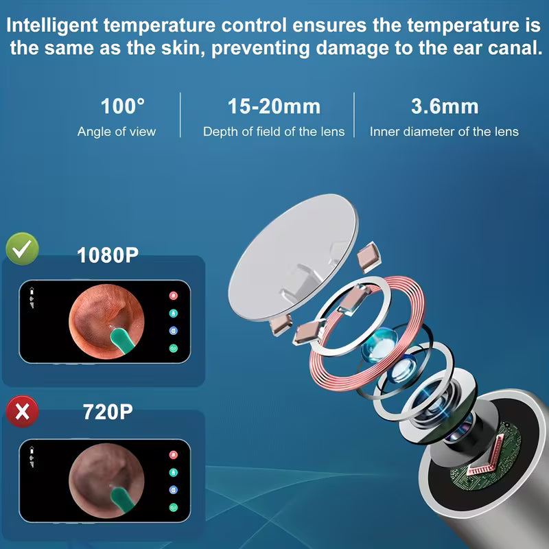 Wireless Earwax Removal Tool Accessories Set – Camera & Light