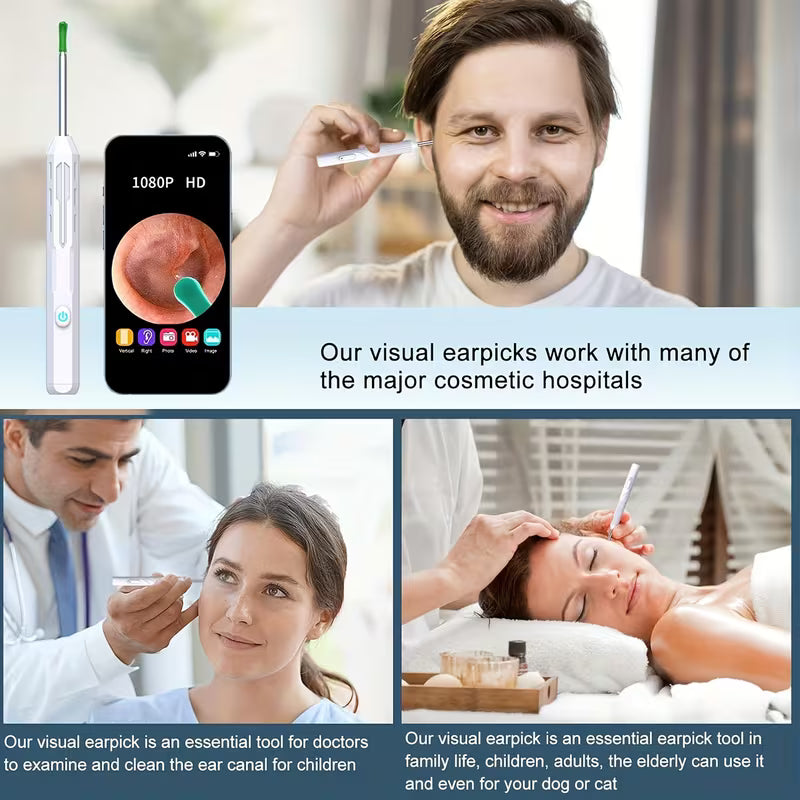 Wireless Earwax Removal Tool Accessories Set – Camera & Light