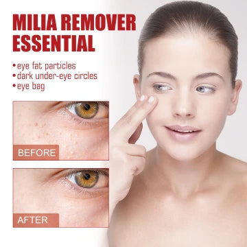 Under-Eye Essence for Milia Removal Brightening Anti-Puffiness Formula