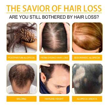 Biotin Hair Growth Spray-30ML