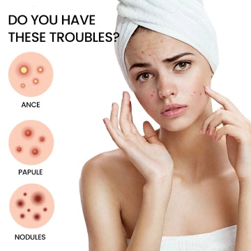 Star Color Acne Patch To Reduce Acne Spots-200PCS