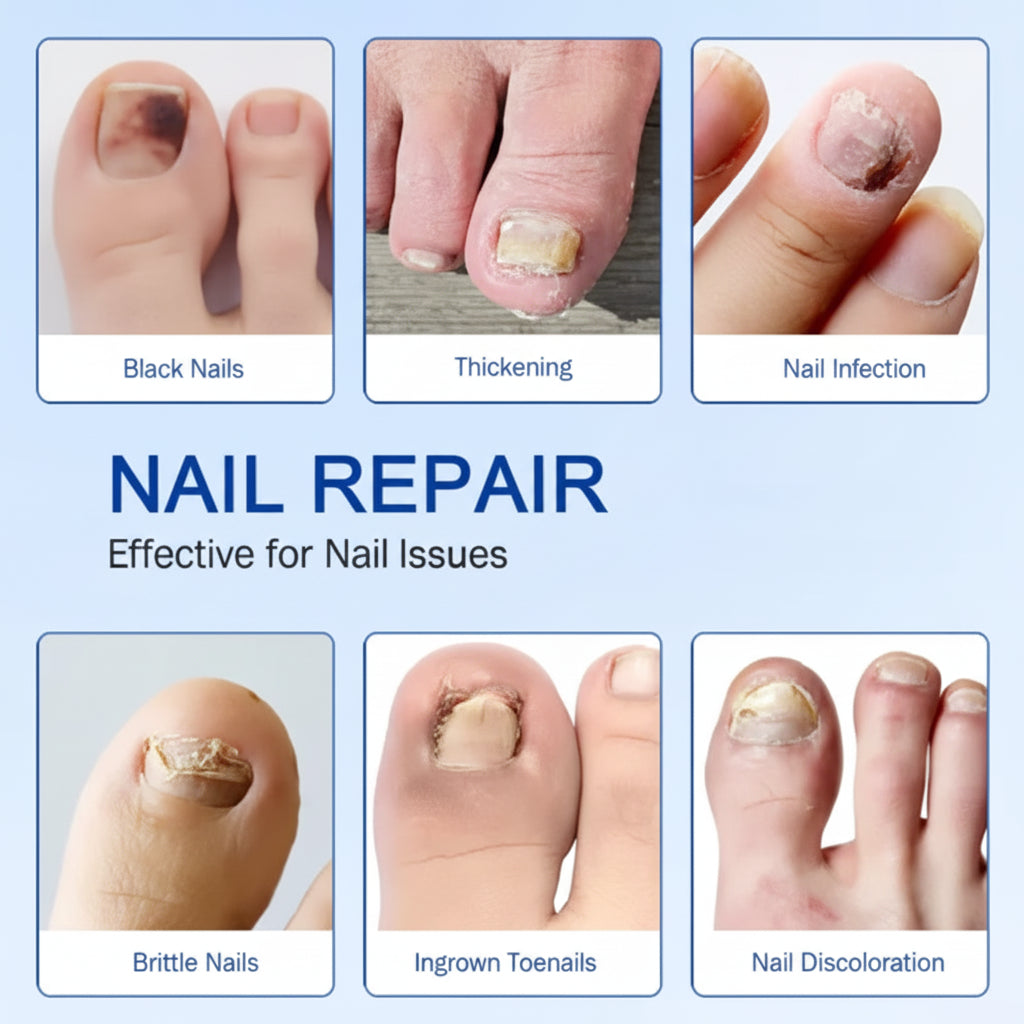Nail Treatment Patches, Toenail Care, & Repair For Damaged Nails