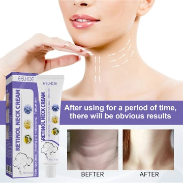 Retinol Neck Cream Lightens Neck Lines, Moisturizes & Firms Neck Skin, Neck Massage Cream