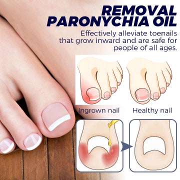 Nail Repair Oil Soothes & Strengthens Toenails