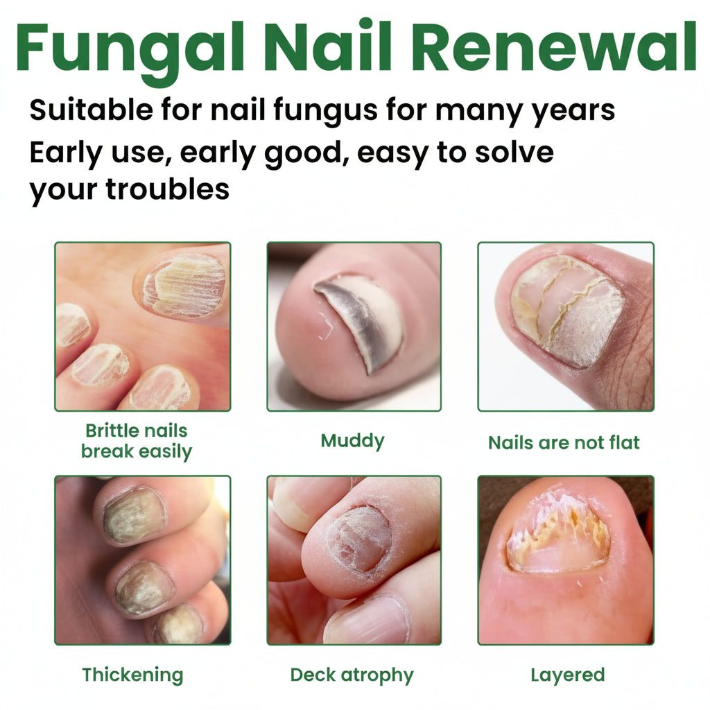 Nail Care Liquid For Hands And Feet