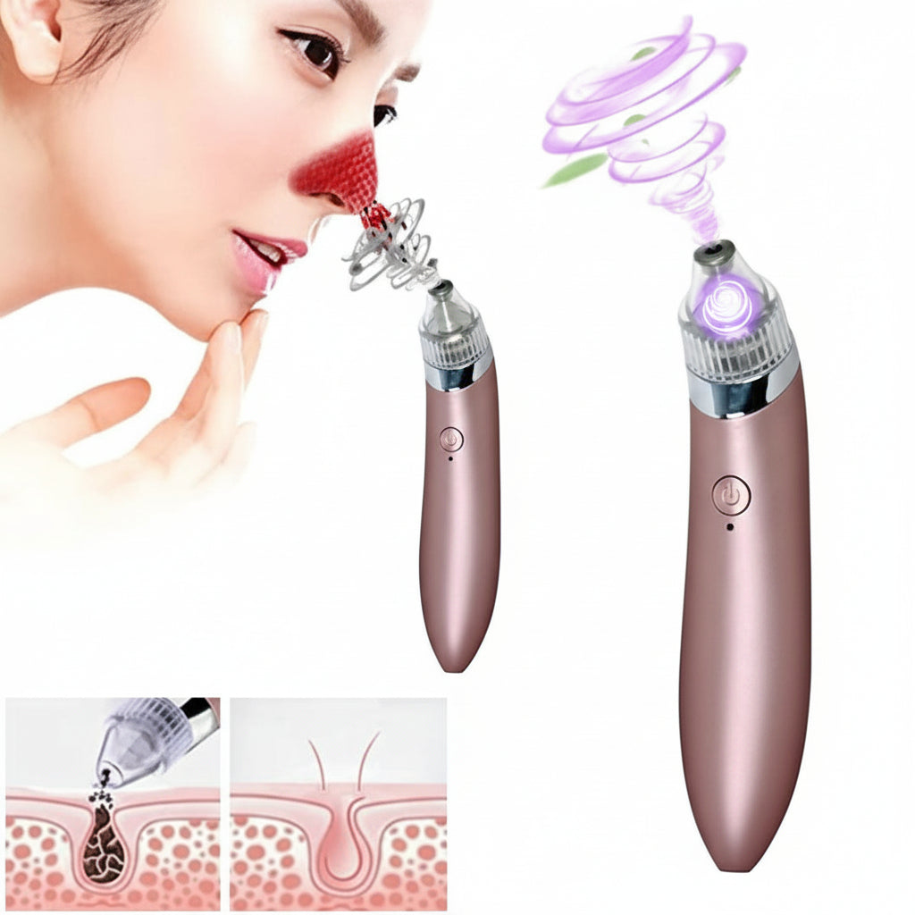 Acne Pore Vacuum Cleaner & Blackhead Remover