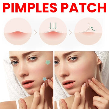 Star Color Acne Patch To Reduce Acne Spots-200PCS