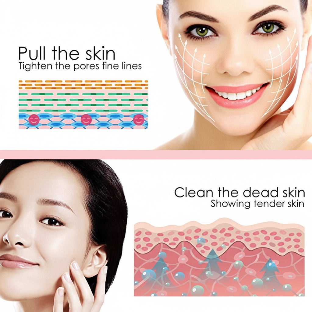 Acne Pore Vacuum Cleaner & Blackhead Remover