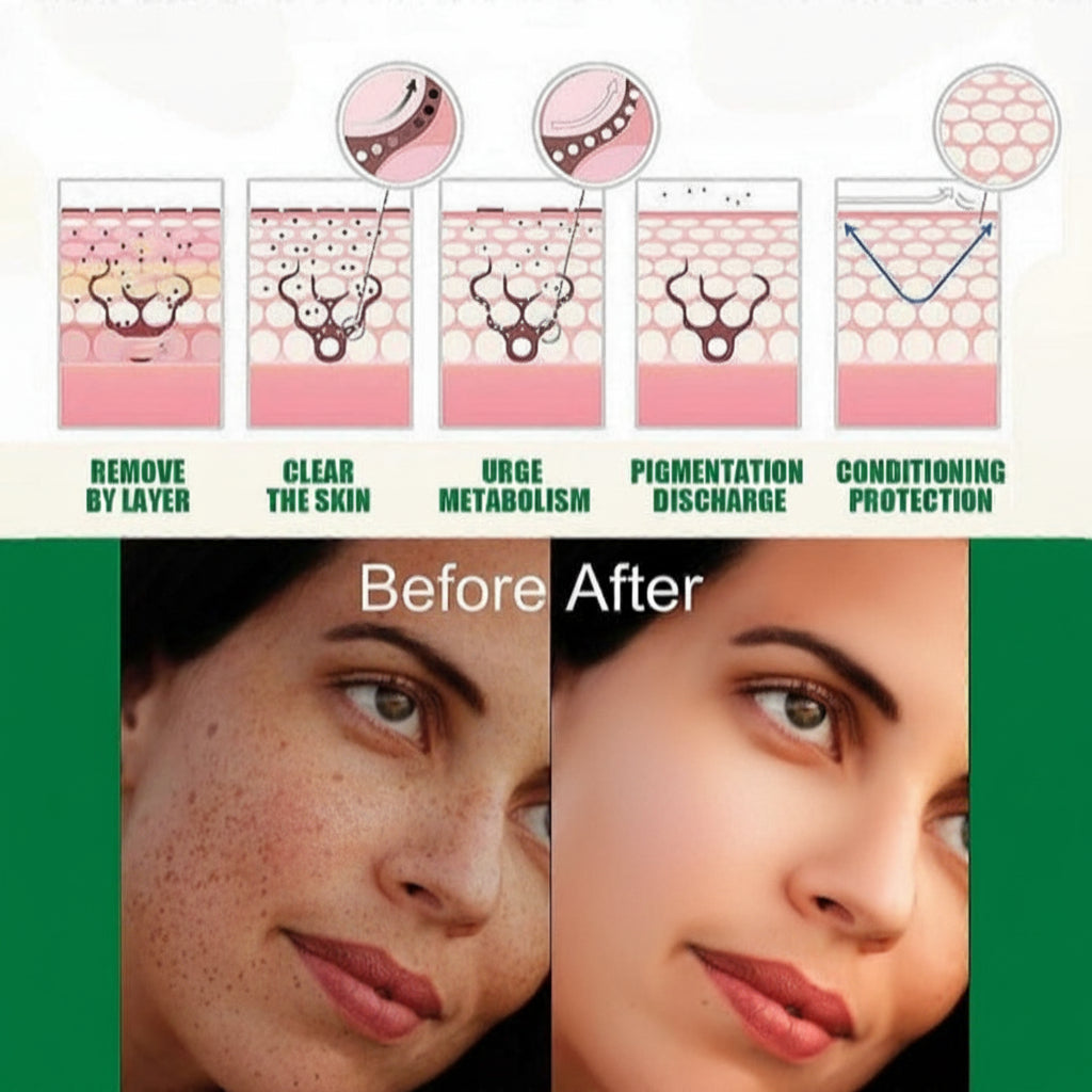 Eelhoe Dark Spot Correcting Glow Serum & Hoygi Niacinamide 10%+TXA 3% Serum