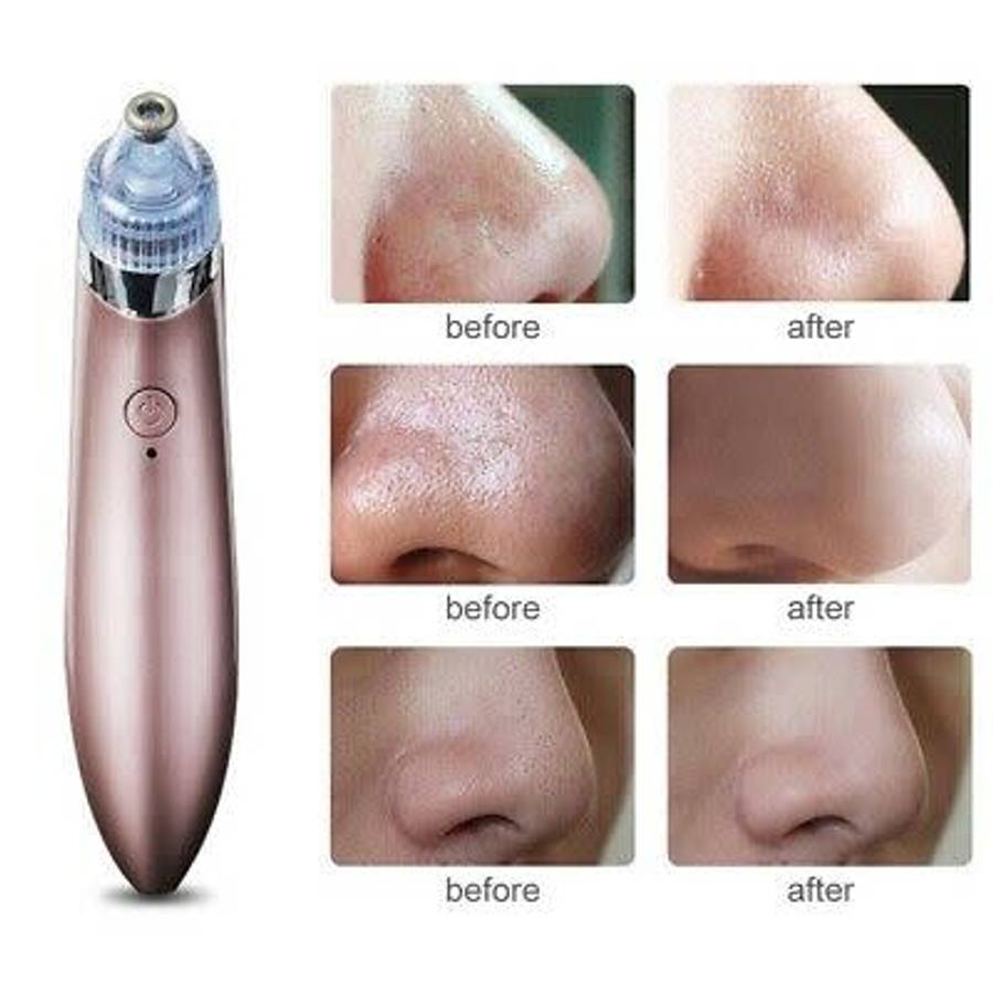Acne Pore Vacuum Cleaner & Blackhead Remover
