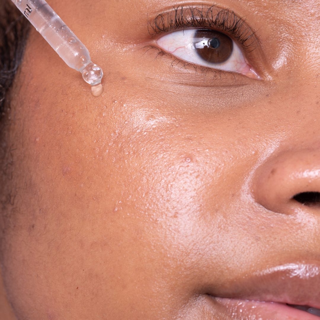 10% Niacinamide & 1% Zinc Serum with Hyaluronic Acid