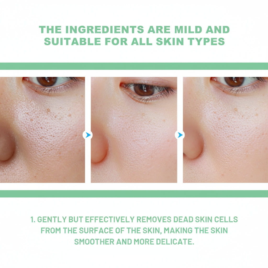 Herbal Exfoliating Gel Gently Cleans Closed Black Mouth & Shrinks Pores