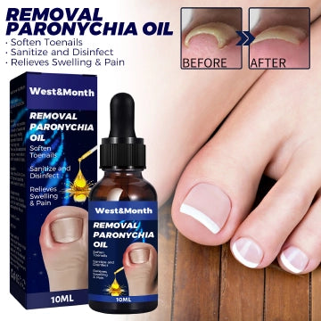 Nail Repair Oil Soothes & Strengthens Toenails